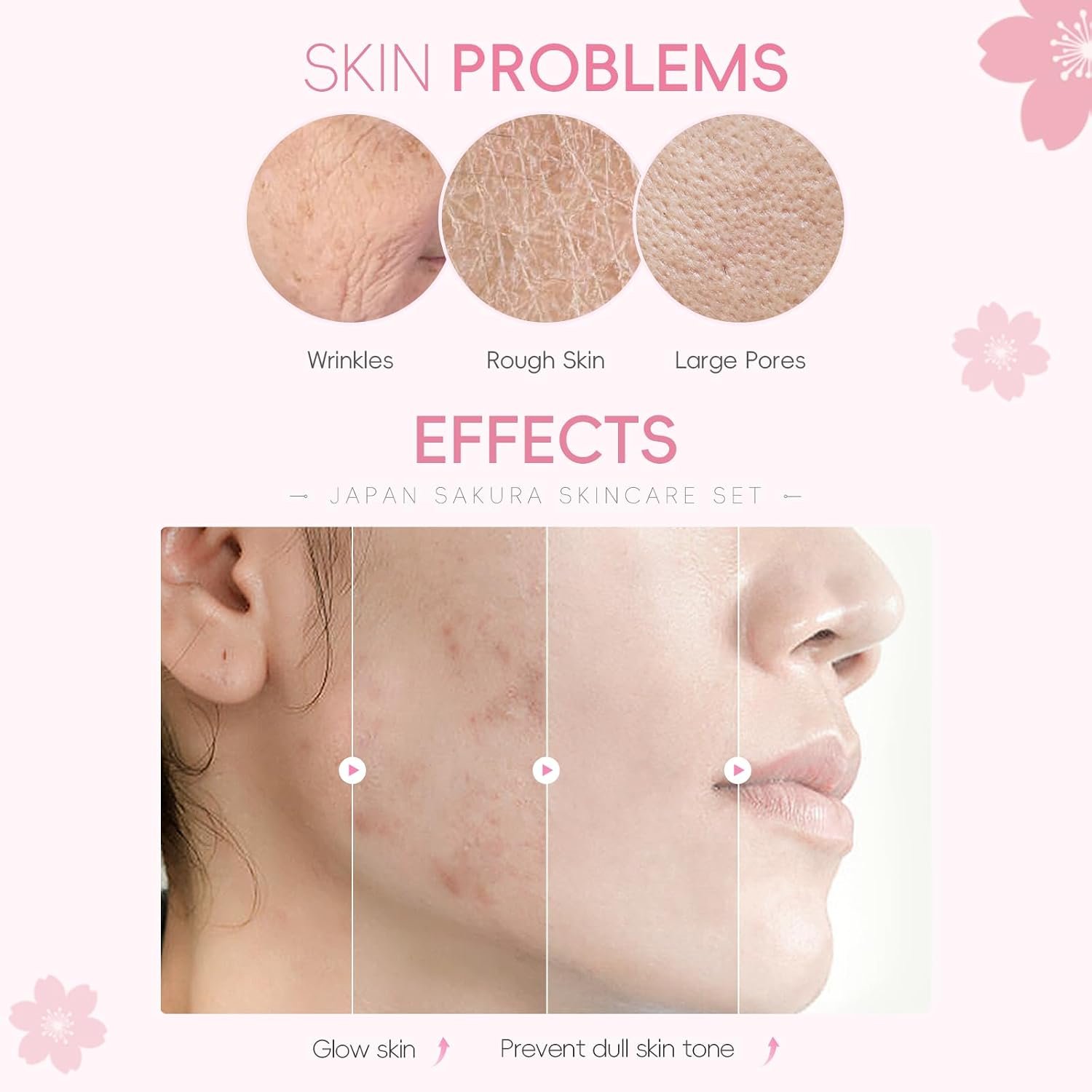 LAIKOU JAPAN SAKURA SKINCARE SET -PURE PERFECTION - Image 5