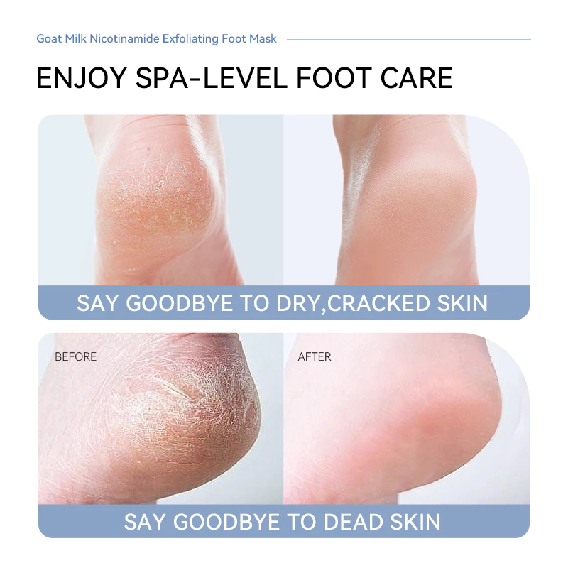 QUIYUM GOAT MILK NICOTINAMIDE EXFOLIATING FOOT MASK - Image 5